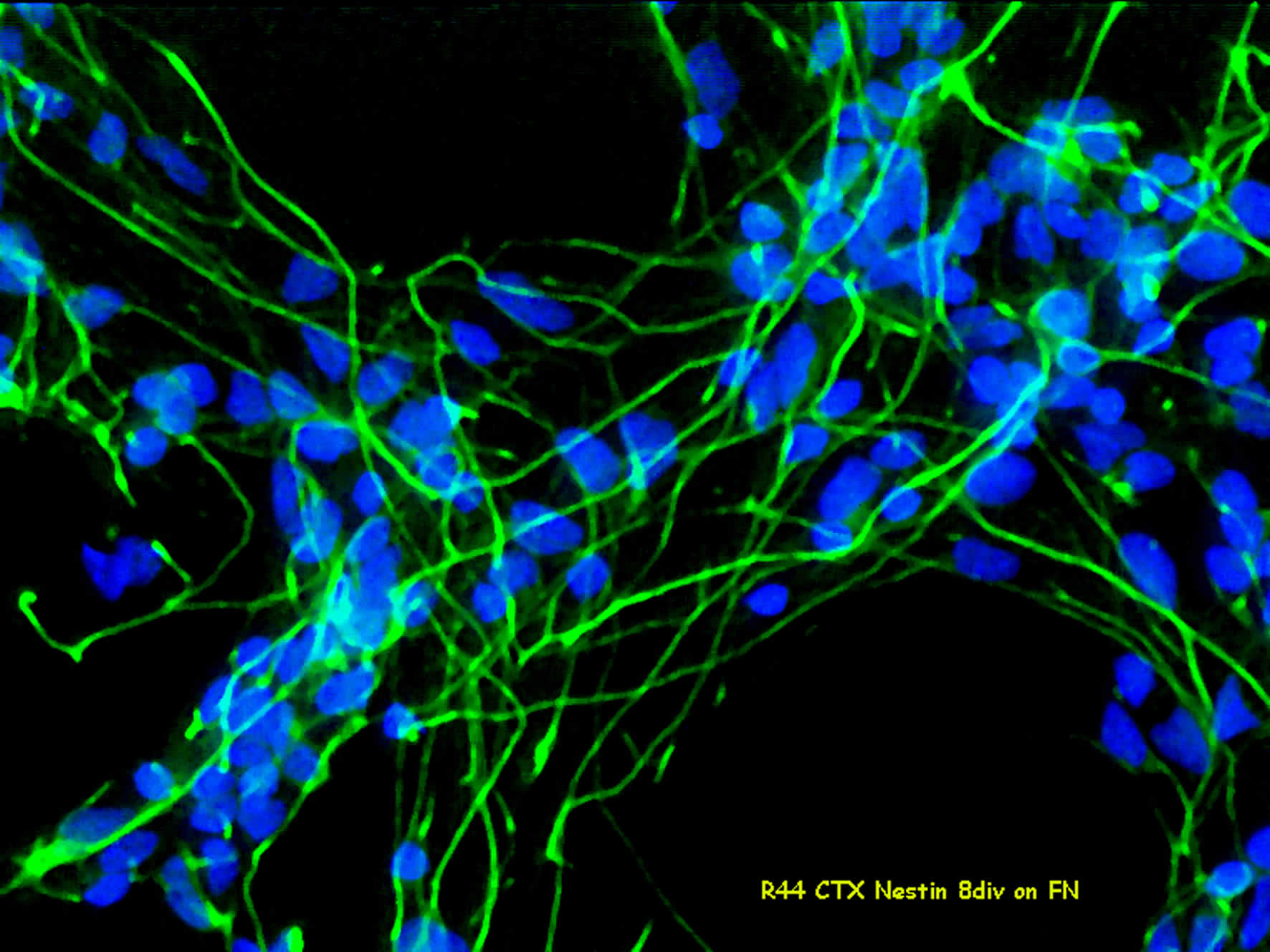 neural stem cells